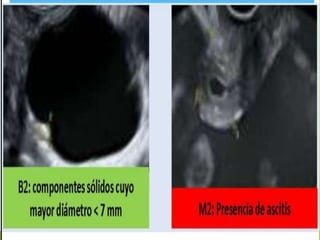 82: componentes sólidos cuyo
mayor diámetro< 7 mm
 