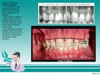 Criterio 4: Cenit del
contorno gingival
.- Normalmente se sitúa
distal al eje medial del
diente, por ello el cuello
tiene el aspecto de un
triangulo.
.- Estas reglas no siempre
se aplican a los incisivos
laterales superiores ni los
incisivos inferiores, el cenit
puede estar centrado en
el eje medial.
.- Las preparaciones deben
respetar esta forma básica
del contorno de la encía. La
colocación cuidadosa del
hilo retractor puede
contribuir.
CPA
CPI
MARGEN
GINGIVAL
 