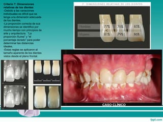Criterio 7: Dimensiones
relativas de los dientes
-Debido a las variaciones
individuales es difícil que se
tenga una dimensión adecuada
de los dientes.
-La proporción correcta de sus
dimensiones se identifico por
mucho tiempo con principios de
arte y arquitectura. “La
proporción Áurea” y “el
porcentaje dorado” para poder
determinar las distancias
ideales.
-Estas reglas se aplicaron al
tamaño aparente de los dientes
vistos desde el plano frontal.
 