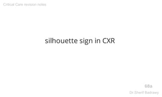 silhouette sign in CXR
68a
Critical Care revision notes
Dr.Sherif Badrawy
 