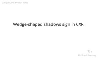 Wedge-shaped shadows sign in CXR
72a
Critical Care revision notes
Dr.Sherif Badrawy
 