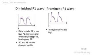 309b
Critical Care revision notes
Dr.Sherif Badrawy
 