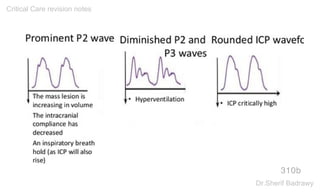 310b
Critical Care revision notes
Dr.Sherif Badrawy
 