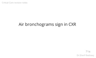 Air bronchograms sign in CXR
71a
Critical Care revision notes
Dr.Sherif Badrawy
 