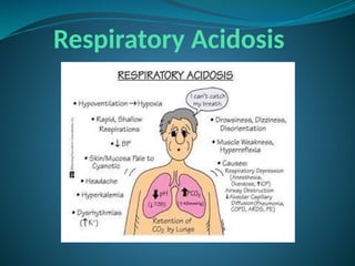 Respiratory Acidosis
 