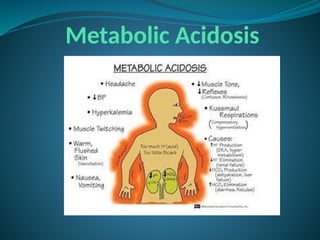 Metabolic Acidosis
 