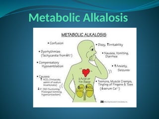Metabolic Alkalosis
 