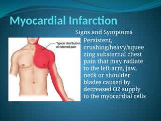 Myocardial Infarction
Signs and Symptoms
• Persistent,
crushing/heavy/squee
zing substernal chest
pain that may radiate
to the left arm, jaw,
neck or shoulder
blades caused by
decreased O2 supply
to the myocardial cells
 