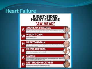Heart Failure
 