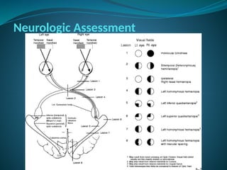 Neurologic Assessment
 