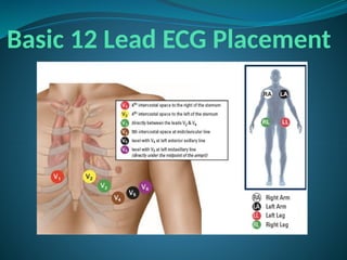 Basic 12 Lead ECG Placement
 