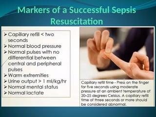 Markers of a Successful Sepsis
Resuscitation
 