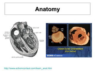 Systolic anterior motion of mitral valve - SAM | PPT