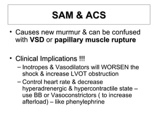 Systolic anterior motion of mitral valve - SAM | PPT