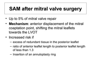 Systolic anterior motion of mitral valve - SAM | PPT