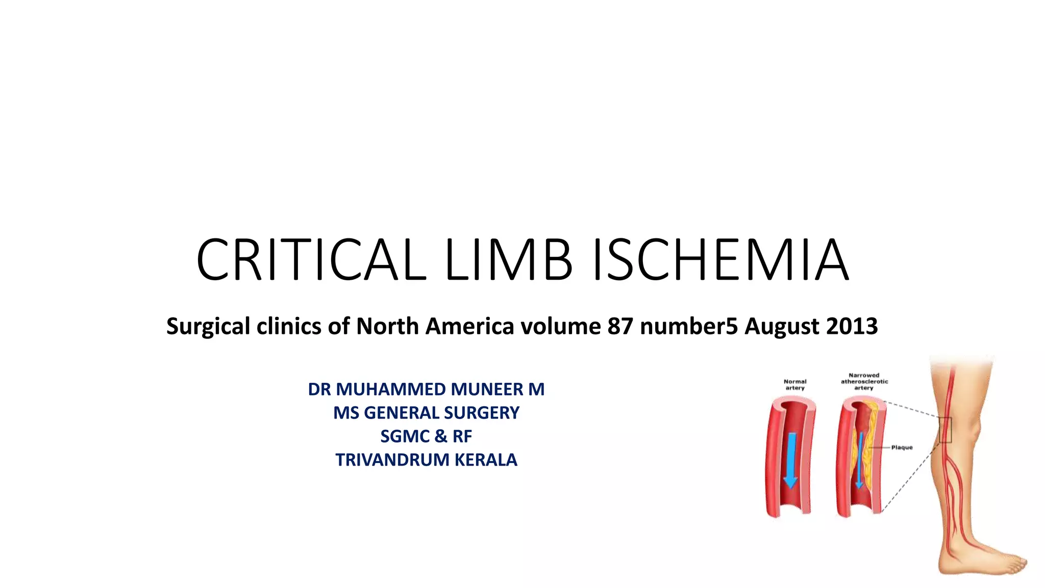 Critical limb ischemia. povd . dr mnr | PPTX