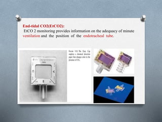 End-tidal CO2(EtCO2): 
EtCO 2 monitoring provides information on the adequacy of minute 
ventilation and the position of the endotracheal tube. 
16 
 