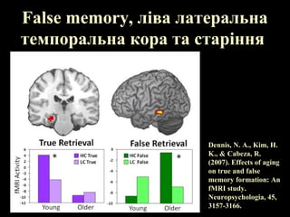 False memory, ліва латеральна
темпоральна кора та старіння
Dennis, N. A., Kim, H.
K., & Cabeza, R.
(2007). Effects of aging
on true and false
memory formation: An
fMRI study.
Neuropsychologia, 45,
3157-3166.
 