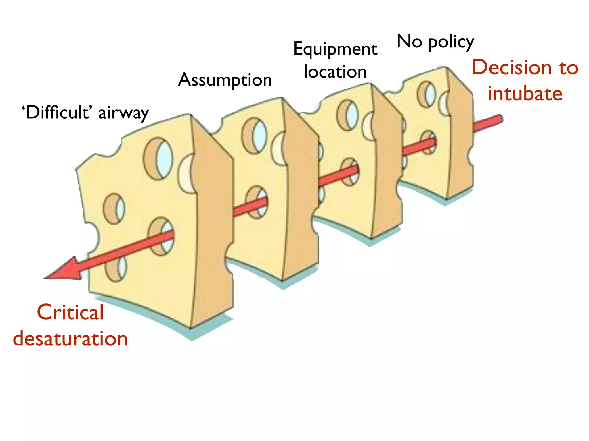 Equipment No policy
                                  location          Decision to
                    Assumption
                                                     intubate
‘Difﬁcult’ airway




  Critical
desaturation
 