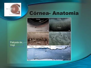 Córnea- Anatomia

Paliçada de
Vogt

 