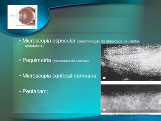 • Microscopia especular (determinação da densidade de células
endoteliais);

• Paquimetria (espessura da córnea);
• Microscopia confocal corneana;
• Pentacam;

 