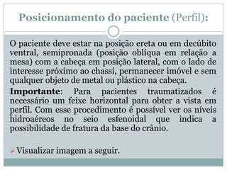 Posicionamento do paciente (Perfil):
O paciente deve estar na posição ereta ou em decúbito
ventral, semipronada (posição oblíqua em relação a
mesa) com a cabeça em posição lateral, com o lado de
interesse próximo ao chassi, permanecer imóvel e sem
qualquer objeto de metal ou plástico na cabeça.
Importante: Para pacientes traumatizados é
necessário um feixe horizontal para obter a vista em
perfil. Com esse procedimento é possível ver os níveis
hidroaéreos no seio esfenoidal que indica a
possibilidade de fratura da base do crânio.
Visualizar imagem a seguir.
 