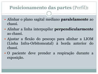 Posicionamento das partes (Perfil):
 Alinhar o plano sagital mediano paralelamente ao
chassi.
 Alinhar a linha interpupilar perpendicularmente
ao chassi.
 Ajustar a flexão do pescoço para alinhar a LIOM
(Linha Infra-Orbitomeatal) à borda anterior do
chassi.
 O paciente deve prender a respiração durante a
exposição.
 