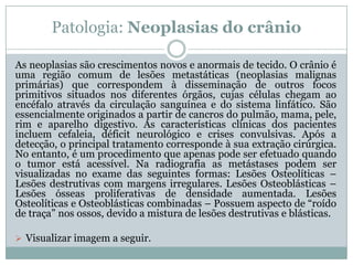 Patologia: Neoplasias do crânio
As neoplasias são crescimentos novos e anormais de tecido. O crânio é
uma região comum de lesões metastáticas (neoplasias malignas
primárias) que correspondem à disseminação de outros focos
primitivos situados nos diferentes órgãos, cujas células chegam ao
encéfalo através da circulação sanguínea e do sistema linfático. São
essencialmente originados a partir de cancros do pulmão, mama, pele,
rim e aparelho digestivo. As características clínicas dos pacientes
incluem cefaleia, déficit neurológico e crises convulsivas. Após a
detecção, o principal tratamento corresponde à sua extração cirúrgica.
No entanto, é um procedimento que apenas pode ser efetuado quando
o tumor está acessível. Na radiografia as metástases podem ser
visualizadas no exame das seguintes formas: Lesões Osteolíticas –
Lesões destrutivas com margens irregulares. Lesões Osteoblásticas –
Lesões ósseas proliferativas de densidade aumentada. Lesões
Osteolíticas e Osteoblásticas combinadas – Possuem aspecto de “roído
de traça” nos ossos, devido a mistura de lesões destrutivas e blásticas.
 Visualizar imagem a seguir.
 
