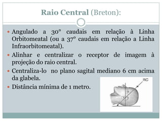 Raio Central (Breton):
 Angulado a 30° caudais em relação à Linha
Orbitomeatal (ou a 37° caudais em relação a Linha
Infraorbitomeatal).
 Alinhar e centralizar o receptor de imagem à
projeção do raio central.
 Centraliza-lo no plano sagital mediano 6 cm acima
da glabela.
 Distância mínima de 1 metro.
 
