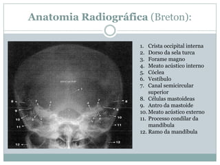 Anatomia Radiográfica (Breton):
1. Crista occipital interna
2. Dorso da sela turca
3. Forame magno
4. Meato acústico interno
5. Cóclea
6. Vestíbulo
7. Canal semicircular
superior
8. Células mastoideas
9. Antro da mastoide
10. Meato acústico externo
11. Processo condilar da
mandíbula
12. Ramo da mandíbula
 