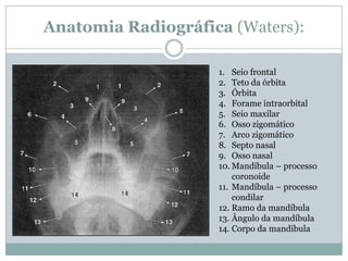Anatomia Radiográfica (Waters):
1. Seio frontal
2. Teto da órbita
3. Órbita
4. Forame intraorbital
5. Seio maxilar
6. Osso zigomático
7. Arco zigomático
8. Septo nasal
9. Osso nasal
10. Mandíbula – processo
coronoide
11. Mandíbula – processo
condilar
12. Ramo da mandíbula
13. Ângulo da mandíbula
14. Corpo da mandíbula
 
