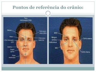 Pontos de referência do crânio:
 