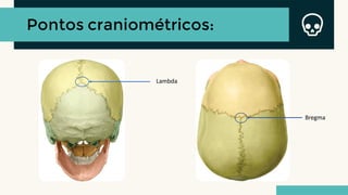 Pontos craniométricos:
Lambda
Bregma
 