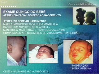 SCM
                                            Leve o seu Bebê ao Dentista


 EXAME CLÍNICO DO BEBÊ
 APARÊNCIA FACIAL DO BEBÊ AO NASCIMENTO

 PERFIL DO BEBÊ AO NASCIMENTO
 MAXILA MAIS PROJETADA QUE A MANDILULA
 DANDO UM ASPECTO DE CLASSE II –
 MANDIBULA MAIS DISTAL - +/-5ª6mm-Korkhaus-1958
 COMPENSADO ATÉ OS 6 MESES DE VIDA ATRAVÉS DA SUCÇÃO




                5ª6mm




                                               MODELAÇÃO
                                               INTRA UTERINA
 CLINCH,SILLMAN,GARCIA,ANDO(1973)
 
