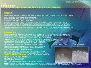 Leve o seu Bebe ao Dentista
SCM
 OBSEVAÇÕES RADIOGRÁFICAS AO NASCIMENTO

 MAXILA
 IMAGENS RADIOGRÁFICAS SUGEREM ESTAR OS INCISIVOS CENTRAIS
 COM 5/6 DE COROAS FORMADAS;
 2/3 DE COROAS DOS LATERAIS;
 1/3 DE COROAS DOS CANINOS E POSICIONADOS POR VESTIBULAR.
 MOLARES COM CUSPIDES MINERALIZADAS MAS SEM UNIÃO TOTAL.
 CRESCIMENTO TRANSVERSAL DEVIDO A SUTURA PALATINA MEDIANA.

 MANDIBULA
 OS INCISIVOS APRESENTAM –SE C0M 3/5 DAS COROAS FORMADAS
 OS CANINOS COM PARTE INCISAL CALCIFICADA.
 PMID COM CÚSPIDES CALCIFICADAS E UNIDAS E SMID COM
 CUSPIDES CALCIFICADAS E NÃO UNIDAS.
 JÁ NOTAMOS UMA CÚSPIDE MV DO PMP.            5 DIAS MD   1 A E 8M MD
 CRESCIMENTO TRANSVERSAL DEVIDO A
  SINCONDROSE SINFISIANA.
 ELA SE SOLDA AOS SEIS MESES DE VIDA.
 SINFISE MENTONIANA APRESENTA-SE AINDA
 ABERTA AO NASCIMENTO.
 DENTES APINHADOS
 NÃO HÁ OSSO NAS INCISAIS E OCLUSAIS.
 ATM FOSSA ARTICULAR CÔNCAVA, RASA ,CABECA DA MANDIBULA ACHATADA.
 