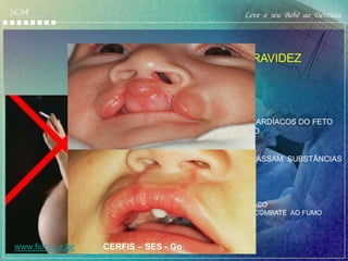 SCM                                                          Leve o seu Bebê ao Dentista




                         FUMO DURANTE A GRAVIDEZ




                         -AUMENTO DOS BATIMENTOS CARDÍACOS DO FETO
                         -DIMINUIÇÃO DO PESO DO FETO
                         -ALTERAÇÕES NEUROLÓGICAS
                         --ABORTO ESPONTÂNEO
                         --DURANTE A AMAMENTAÇÃO PASSAM SUBSTÂNCIAS
                         TÓXICAS PARA O BEBÊ.

                         -INCA – DATAS IMPORTANTES

                         -31 DE MAIO DIA MUNDIAL SEM TABACO
                         -29 DE AGOSTO DIA NACIONAL DE COMBATE AO FUMO

                         -Hipolasia de esmalte
                         -Lábio fissurado e fenda palatina
www.fiocru z,br   CERFIS – SES - Go
 