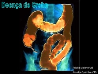 Doença de Crohn Pricilla Meier nº 23 Jessika Gusmão nº13 