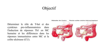Objectif
Déterminer le rôle de T-bet et des
cytokines pro-inflammatoires dans
l'induction de réponses Th1 en MC
humaine et les différences dans les
réponses immunitaires entre MC et la
colite ulcéreuse (CU).
 