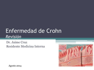 Enfermedad de Crohn
Revisión
Dr. Jaime Cruz
Residente Medicina Interna
Agosto 2014
 