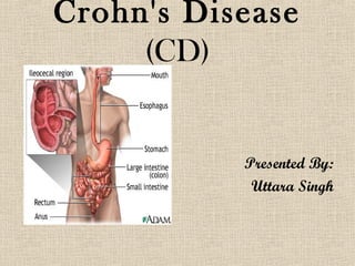 Crohn's Disease
     (CD)


           Presented By:
            Uttara Singh
 