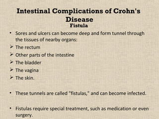 Intestinal Complications of Crohn's
                  Disease
                              Fistula
•   Sores and ulcers can become deep and form tunnel through
    the tissues of nearby organs:
   The rectum
   Other parts of the intestine
   The bladder
   The vagina
   The skin.

• These tunnels are called "fistulas," and can become infected.

• Fistulas require special treatment, such as medication or even
  surgery.
 