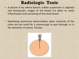 Radiologic Tests
• A barium X-ray where barium sulfate suspension is ingested
  and fluoroscopic images of the bowel are taken to check
  inflammation and narrowing of the small bowel.

• Identifying anatomical abnormalities when strictures of the
  colon are too small for a colonoscope to pass through, or in
  the detection of colonic fistulae.
 