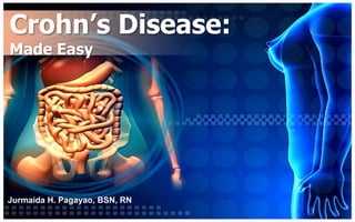 Crohn’s Disease:
Made Easy




Jurmaida H. Pagayao, BSN, RN
 