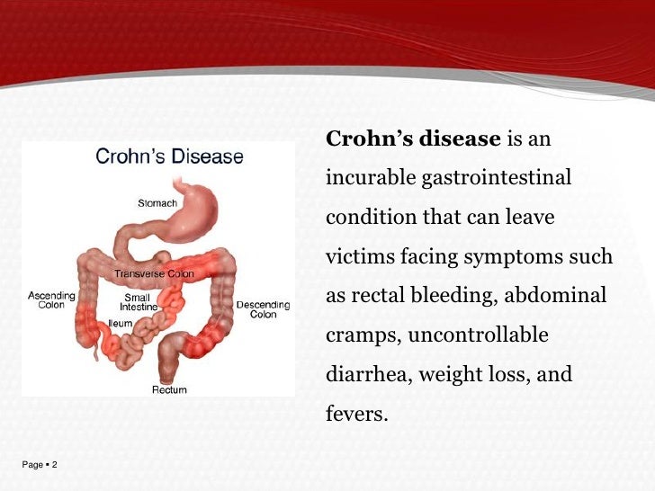 Morbo Di Crohn Si Può Morire