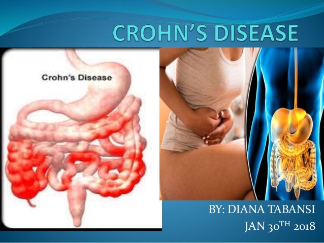 Crohn S Disease