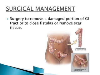  Surgery to remove a damaged portion of GI
tract or to close fistulas or remove scar
tissue.
 