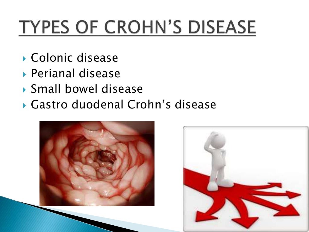 Crohn's disease with Nursing management