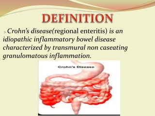 Crohn's disease