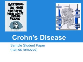 Crohn's Disease
Sample Student Paper
(names removed)
 