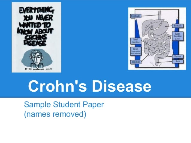 research paper for crohns disease Learn about what crohn's disease is and the causes of crohn's from the crohn's and colitis foundation support our research. research paper for crohns disease Learn about what crohn's disease is and the causes of crohn's from the crohn's and colitis foundation support our research.